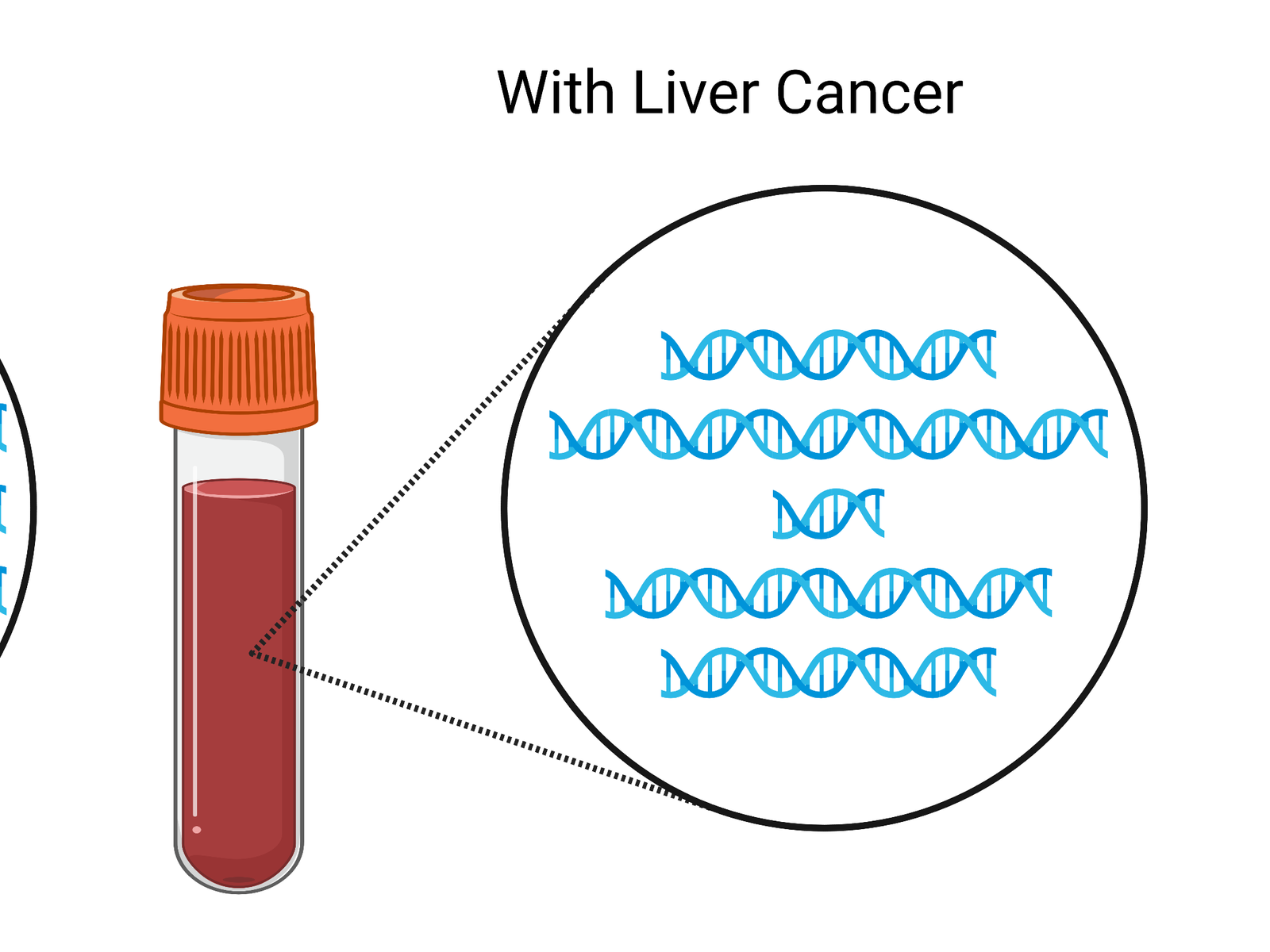 blood-test-uses-fragmentomics-to-detect-liver-cancer-meefro